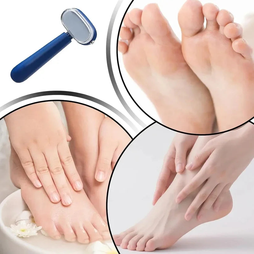 Avelynis Dual-Sided Foot Callus Remover