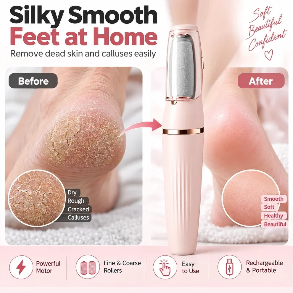 Avelynis™ Electric Foot File 👣 Smooth Rough, Dry Heels in Minutes