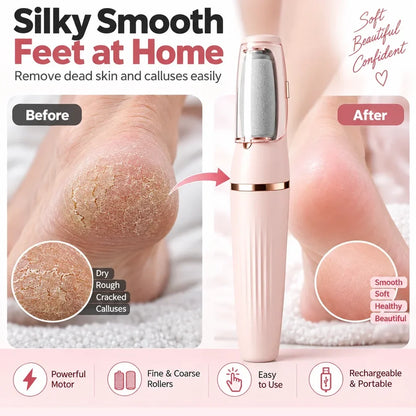 Avelynis™ Electric Foot File 👣 Smooth Rough, Dry Heels in Minutes