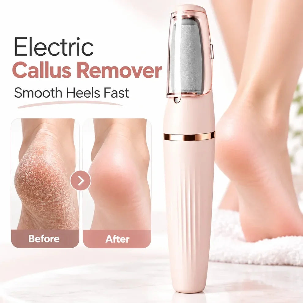 Avelynis™ Electric Foot File 👣 Smooth Rough, Dry Heels in Minutes