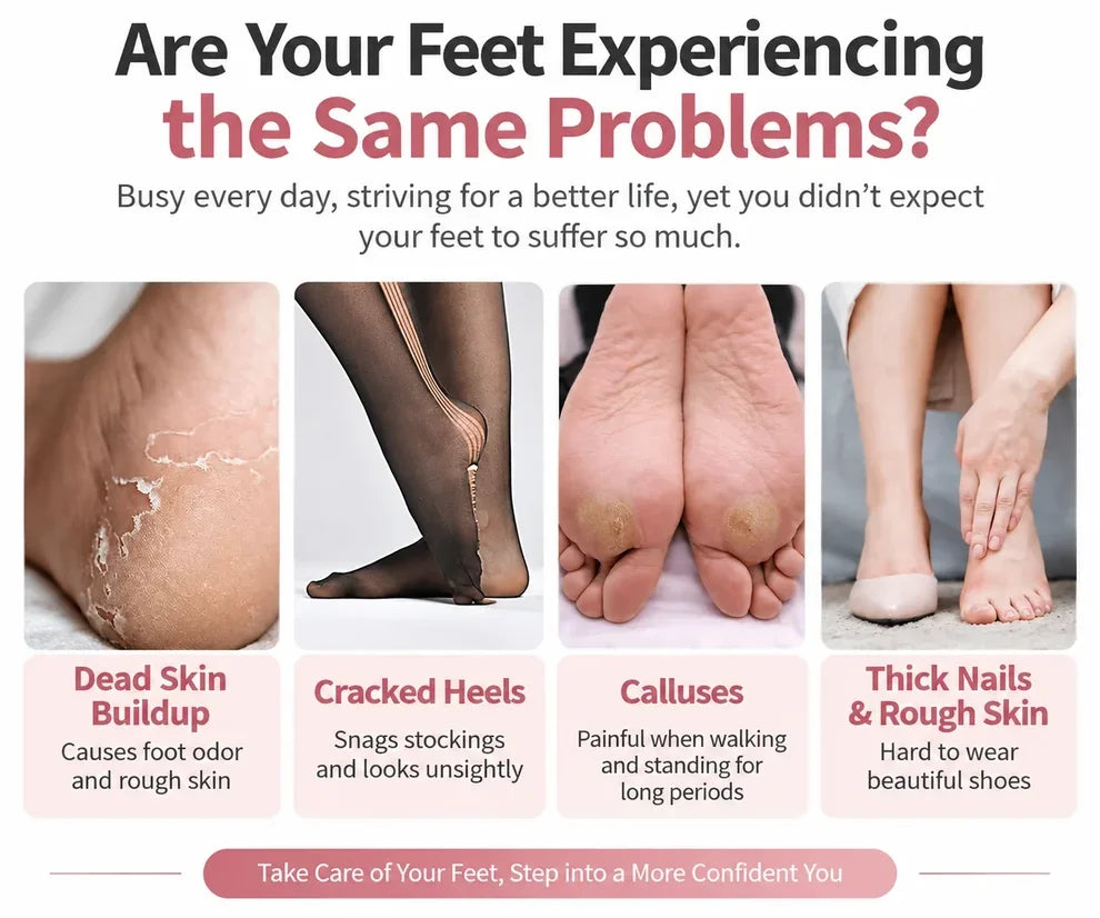 Avelynis™ Electric Foot File 👣 Smooth Rough, Dry Heels in Minutes